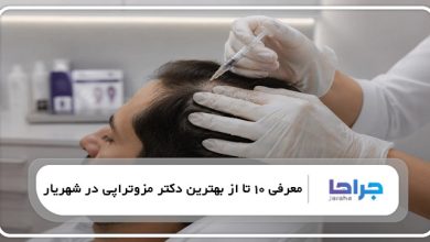 بهترین دکتر مزوتراپی در شهریار