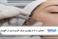 بهترین مرکز خالبرداری در شهریار