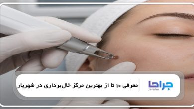 بهترین مرکز خالبرداری در شهریار
