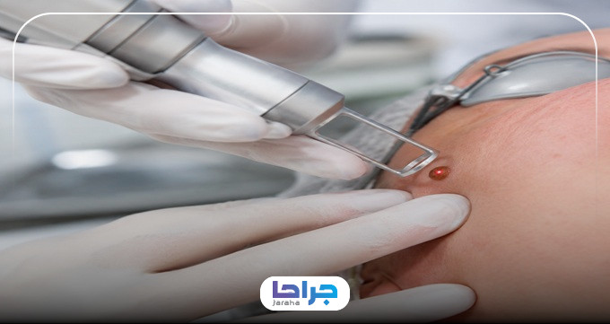 ویژگیهای بهترین مرکز خالبرداری در شهریار