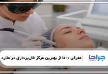 بهترین مرکز خال‌برداری در ملارد