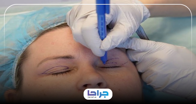 نکات کلیدی در انتخاب بهترین جراح بلفاروپلاستی در زعفرانیه