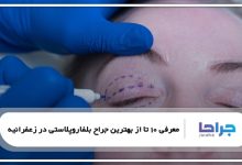 بهترین جراح بلفاروپلاستی در زعفرانیه