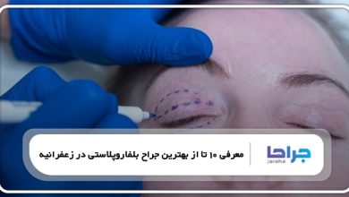بهترین جراح بلفاروپلاستی در زعفرانیه