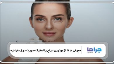 بهترین جراح پلاستیک صورت در زعفرانیه