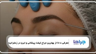 بهترین جراح لیفت پیشانی و ابرو در زعفرانیه