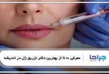 بهترین دکتر تزریق ژل در اندیشه