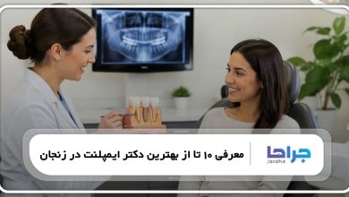 بهترین دکتر ایمپلنت در زنجان