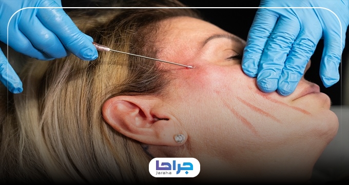 چگونه بهترین دکتر لیفت صورت با نخ را انتخاب کنیم؟