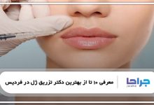 بهترین دکتر تزریق ژل در فردیس
