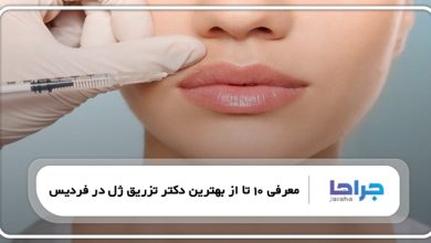 بهترین دکتر تزریق ژل در فردیس