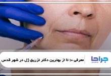 بهترین دکتر تزریق ژل در شهر قدس