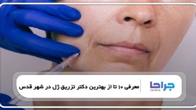 بهترین دکتر تزریق ژل در شهر قدس