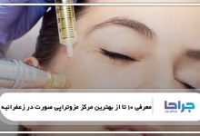 بهترین مرکز مزوتراپی صورت در زعفرانیه