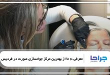 بهترین مرکز جوانسازی صورت در فردیس