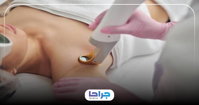 چرا انتخاب بهترین کلینیک لیزر موهای زائد اهمیت دارد؟