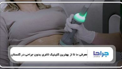 بهترین کلینیک لاغری بدون جراحی در گلستان