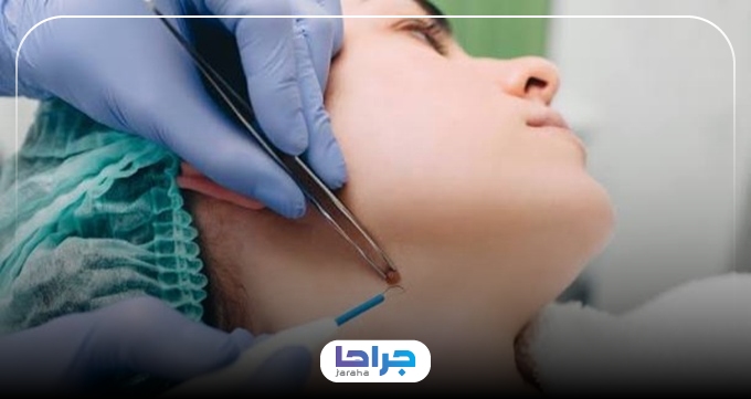برای برداشتن خال چرا باید به بهترین مرکز مراجعه کنیم؟