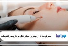 بهترین مرکز خال برداری در اندیشه