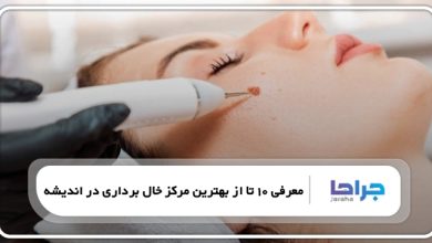 بهترین مرکز خال برداری در اندیشه