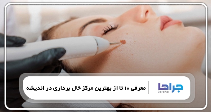 بهترین مرکز خال برداری در اندیشه