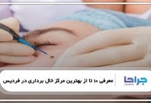 بهترین مرکز خال برداری در فردیس