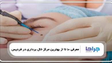 بهترین مرکز خال برداری در فردیس