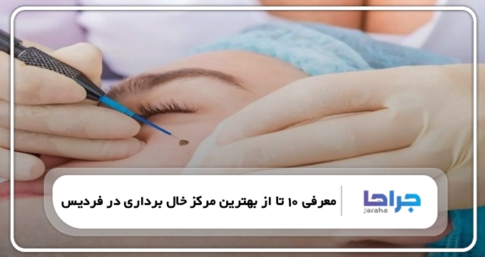 بهترین مرکز خال برداری در فردیس