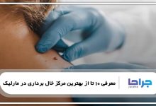 بهترین مرکز خال برداری در مارلیک