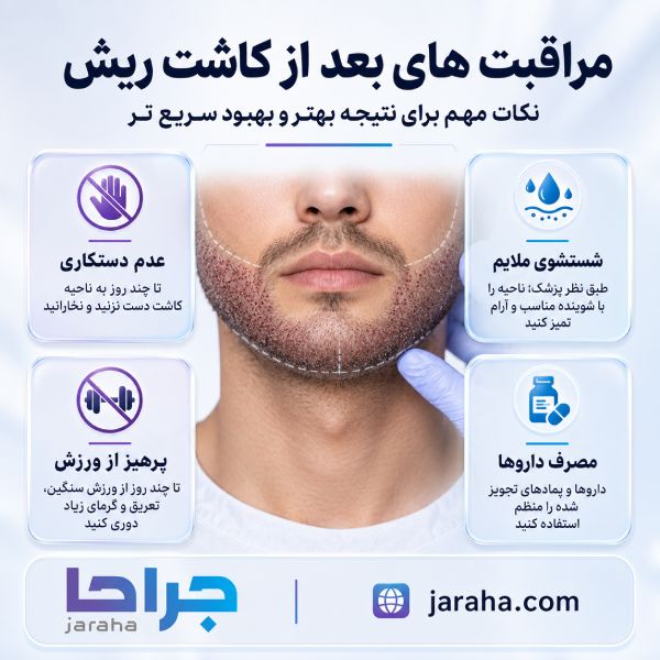 کاشت ریش و مراحل آن