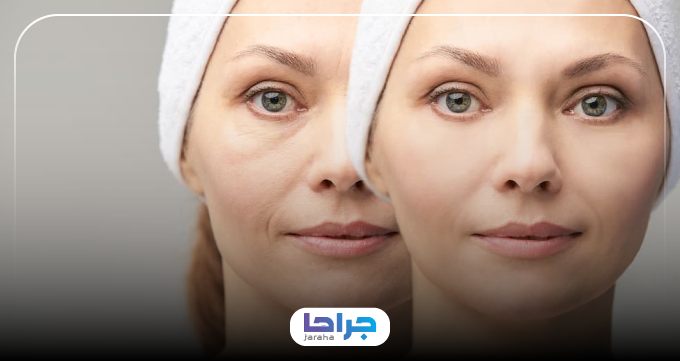 ویژگیهای بهترین دکتر جوانسازی صورت در مشهد