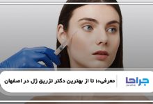 بهترین دکتر تزریق ژل در اصفهان
