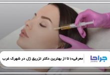 بهترین دکتر تزریق ژل در شهرک غرب