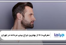 بهترین جراح بینی مردانه در تهران