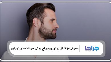 بهترین جراح بینی مردانه در تهران