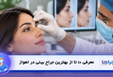 معرفی 10 تا از بهترین جراح بینی در اهواز