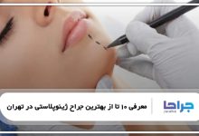 بهترین جراح ژینوپلاستی در تهران