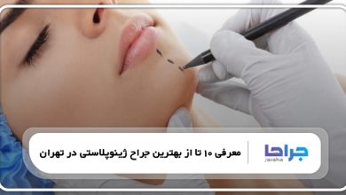 بهترین جراح ژینوپلاستی در تهران