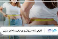 بهترین جراح لیپو 360 در تهران