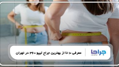 بهترین جراح لیپو 360 در تهران