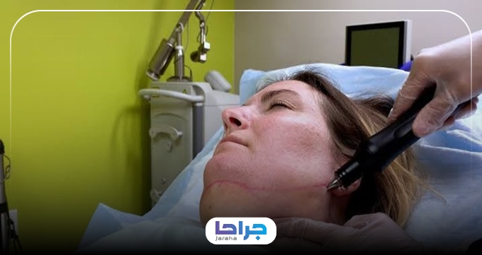 لیفت غبغب با ساکشن برای چه کسانی مناسب است؟