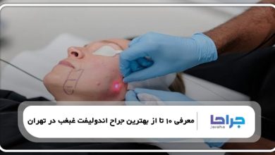 بهترین جراح اندولیفت غبغب در تهران