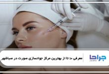 بهترین مرکز جوانسازی صورت در صباشهر