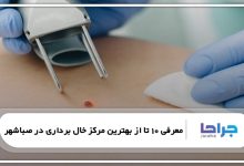 بهترین مرکز خال برداری در صباشهر