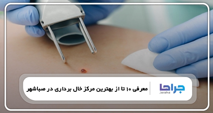 بهترین مرکز خال برداری در صباشهر