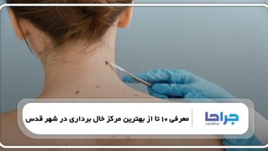 بهترین مرکز خال برداری در شهر قدس