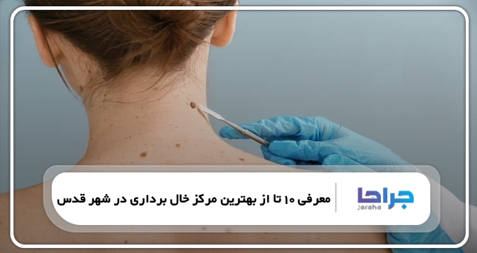 بهترین مرکز خال برداری در شهر قدس