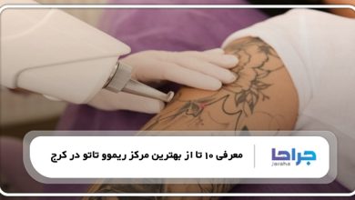 بهترین مرکز پاک کردن تاتو در کرج