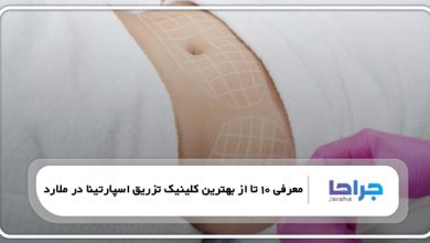 بهترین کلینیک تزریق اسپارتینا در ملارد