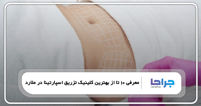 بهترین کلینیک تزریق اسپارتینا در ملارد